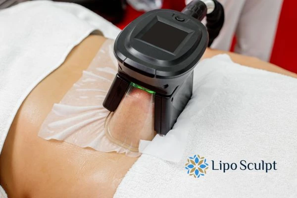 Does Fat Freezing at Home Work? DIY Devices vs Professional Cryolipolysis 1 How is professional cryolipolysis different Swinton?