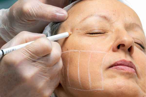 CryoPen: 5 Skin Concerns It May Be Used to Treat 4 What should you ask before having CryoPen treatment Swinton?