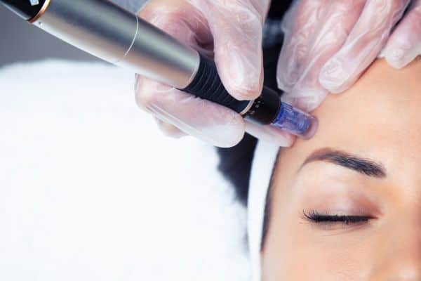 Explaining Total Skin Tightening Treatment and What to Expect 2 What Skin Concerns Can Total Skin Tightening Treatment Help With Swinton?